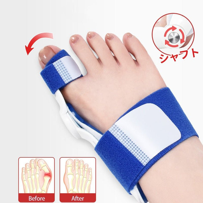 Big Toe Corrector - Flamin' Fitness